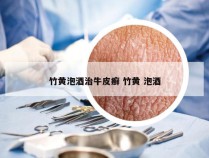竹黄泡酒治牛皮癣 竹黄 泡酒