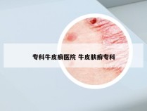 专科牛皮癣医院 牛皮肤癣专科