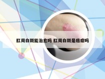 肛周白斑能治愈吗 肛周白斑是癌症吗