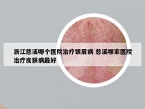 浙江慈溪哪个医院治疗银屑病 慈溪哪家医院治疗皮肤病最好