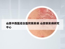 山西中西医结合医院银屑病 山西银屑病研究中心