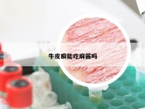 牛皮癣能吃麻酱吗