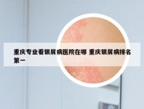 重庆专业看银屑病医院在哪 重庆银屑病排名第一