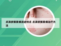 点滴状银屑病消退特点 点滴状银屑病治疗方法