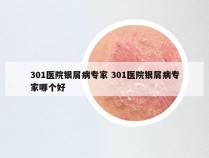 301医院银屑病专家 301医院银屑病专家哪个好