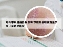 郑州市银屑病协会 郑州市银屑病研究院是公立还是私立医院