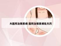 大医院治银屑病 医院治银屑病处方药