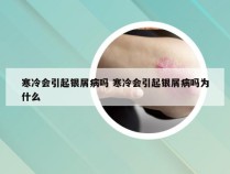 寒冷会引起银屑病吗 寒冷会引起银屑病吗为什么