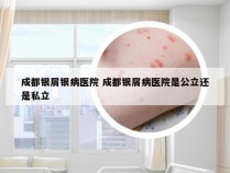 成都银屑银病医院 成都银屑病医院是公立还是私立