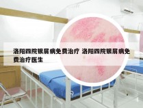 洛阳四院银屑病免费治疗 洛阳四院银屑病免费治疗医生