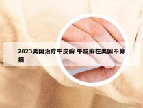 2023美国治疗牛皮癣 牛皮癣在美国不算病