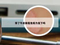 得了牛皮癣是免疫力低下吗