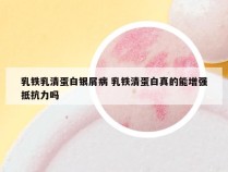 乳铁乳清蛋白银屑病 乳铁清蛋白真的能增强抵抗力吗