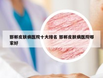 邯郸皮肤病医院十大排名 邯郸皮肤病医院哪家好