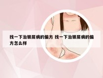 找一下治银屑病的偏方 找一下治银屑病的偏方怎么样