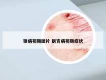 银病初期图片 银宵病初期症状