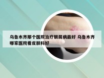 乌鲁木齐那个医院治疗银屑病最好 乌鲁木齐哪家医院看皮肤科好