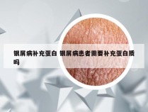 银屑病补充蛋白 银屑病患者需要补充蛋白质吗