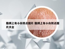 胳膊上有小白斑点图片 胳膊上有小白斑点图片大全