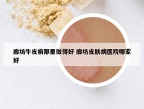 廊坊牛皮癣那里做得好 廊坊皮肤病医院哪家好