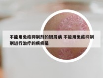 不能用免疫抑制剂的银屑病 不能用免疫抑制剂进行治疗的疾病是