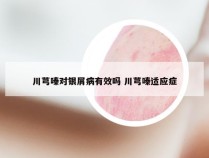川芎嗪对银屑病有效吗 川芎嗪适应症