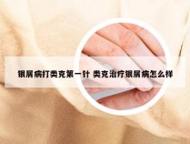 银屑病打类克第一针 类克治疗银屑病怎么样