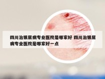 四川治银屑病专业医院是哪家好 四川治银屑病专业医院是哪家好一点