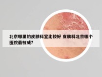北京哪里的皮肤科室比较好 皮肤科北京哪个医院最权威?
