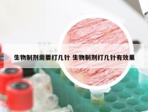 生物制剂需要打几针 生物制剂打几针有效果