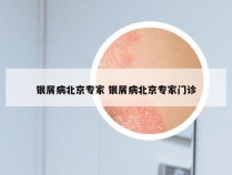 银屑病北京专家 银屑病北京专家门诊