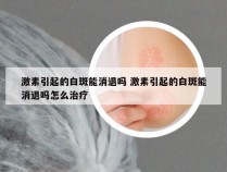 激素引起的白斑能消退吗 激素引起的白斑能消退吗怎么治疗