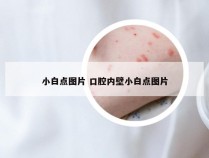 小白点图片 口腔内壁小白点图片