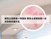 新生儿皮肤有一块发白 新生儿皮肤出现一点点白色的是什么