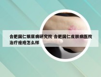 合肥国仁银屑病研究院 合肥国仁皮肤病医院治疗痤疮怎么样