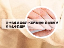 治疗头皮银屑病的中草药有哪些 头皮银屑病用什么中药最好