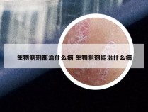 生物制剂都治什么病 生物制剂能治什么病