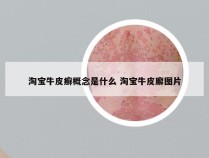 淘宝牛皮癣概念是什么 淘宝牛皮廨图片