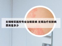 无锡哪家医院专业治银屑病 无锡治疗皮肤病费用是多少