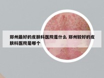 郑州最好的皮肤科医院是什么 郑州较好的皮肤科医院是哪个