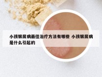 小孩银屑病最佳治疗方法有哪些 小孩银屑病是什么引起的