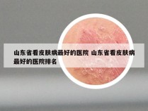 山东省看皮肤病最好的医院 山东省看皮肤病最好的医院排名