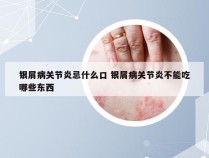 银屑病关节炎忌什么口 银屑病关节炎不能吃哪些东西