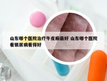 山东哪个医院治疗牛皮癣最好 山东哪个医院看银屑病看得好