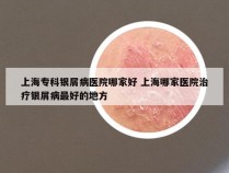 上海专科银屑病医院哪家好 上海哪家医院治疗银屑病最好的地方