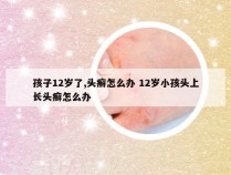 孩子12岁了,头癣怎么办 12岁小孩头上长头癣怎么办