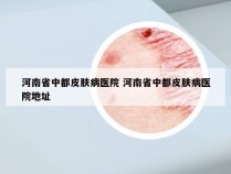 河南省中都皮肤病医院 河南省中都皮肤病医院地址