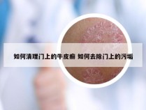 如何清理门上的牛皮癣 如何去除门上的污垢