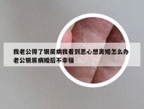 我老公得了银屑病我看到恶心想离婚怎么办 老公银屑病婚后不幸福
