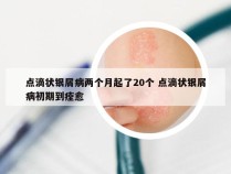 点滴状银屑病两个月起了20个 点滴状银屑病初期到痊愈